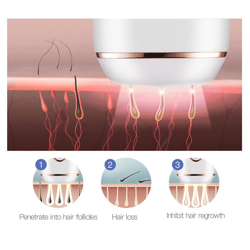 IPL Laser Hair Removal Machine – Painless, Portable & Effective ✨